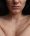 Close-up of the skin of the face and body of a woman with acne and other dermatological problems.