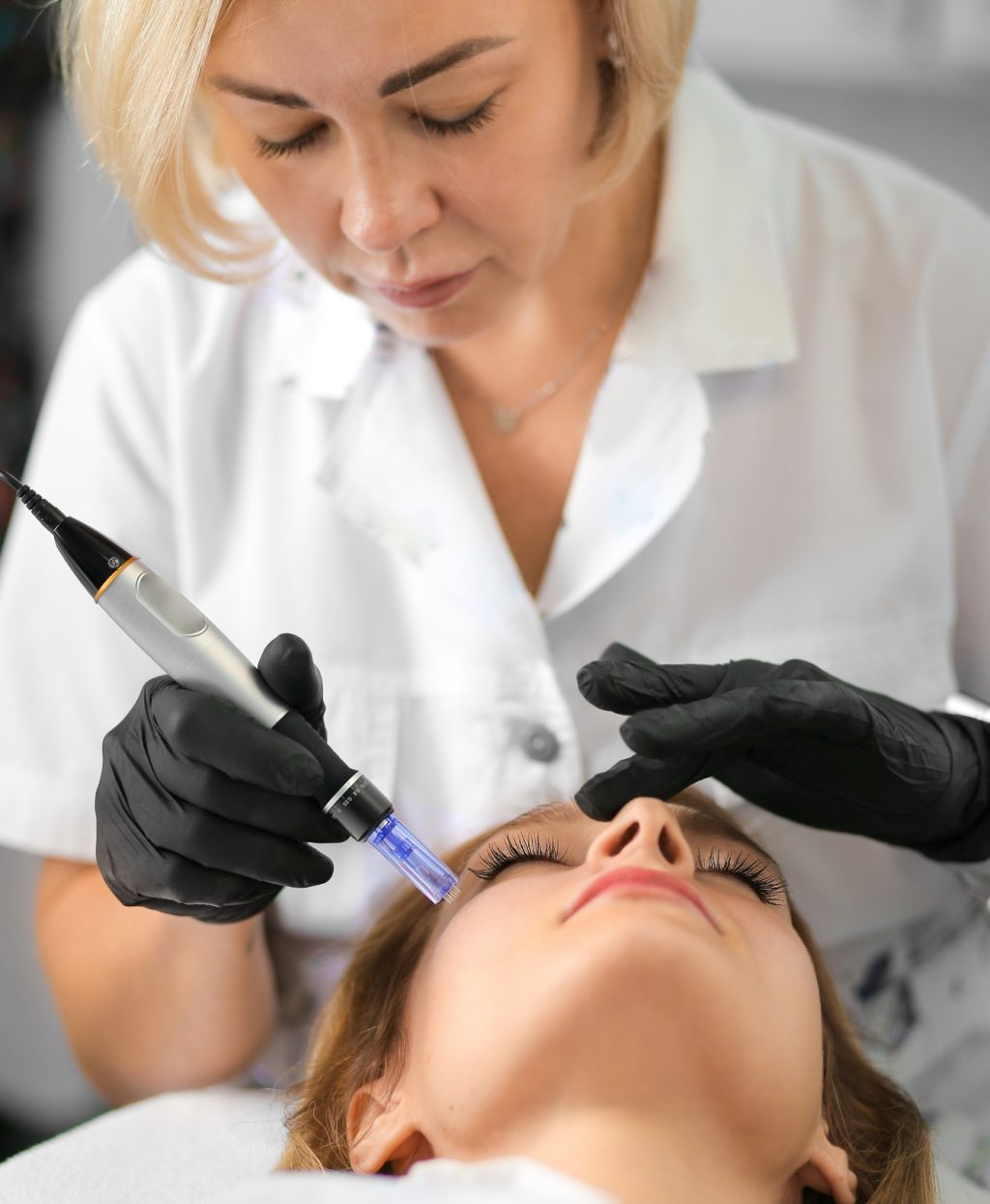 Facial mesotherapy with microneedles