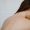 vathis katharismos platis laserskin solutions